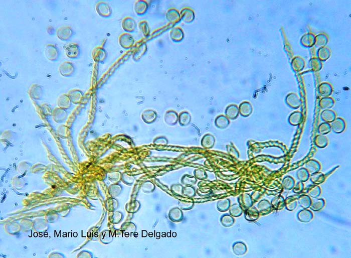 Trichia varia capilicio y esporas